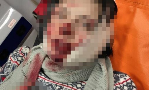 Безжалостно резал лицо: в Киеве сожитель накинулся на женщину, — ФОТО