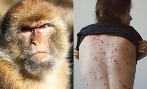 В Україні зафіксували перший випадок віспи мавп
