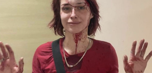 В Одесі 19-річну дівчину побив співробітник ТЦК: розпочали кримінальне провадження