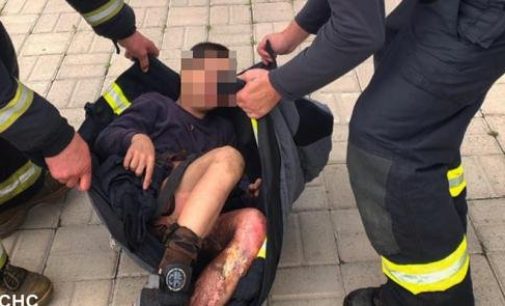 Підлітка з Одещини вдарило струмом на даху вагона, — ФОТО